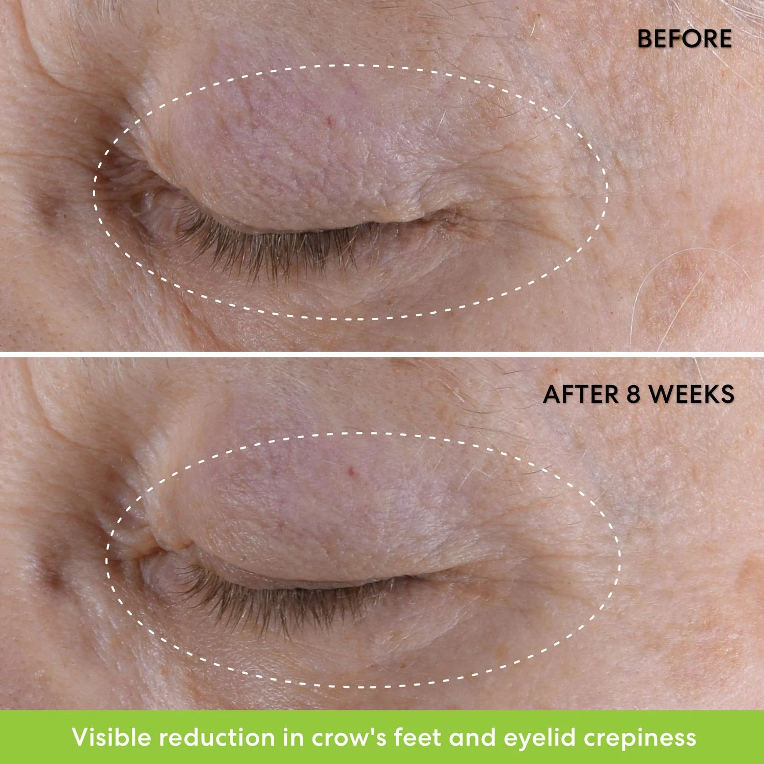 Skincare Ageless Phyto-Retinol Augencreme – Anti-Falten-Augencreme