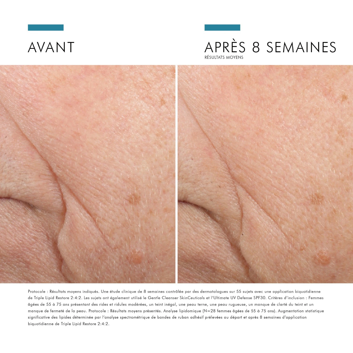 SkinCeuticals Trostruko obnavljanje lipida