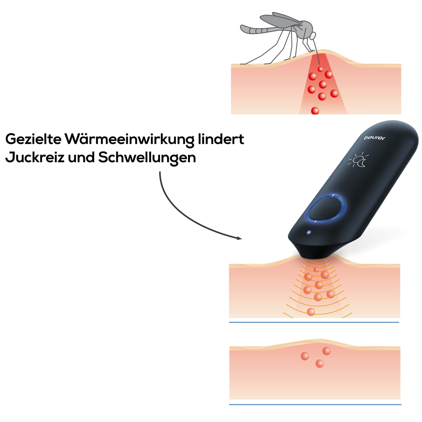 Beurer Insektenstichheiler BR 90-Insektenstichheiler zur Behandlung von Insektenstichen & -bissen mit praktischem Licht