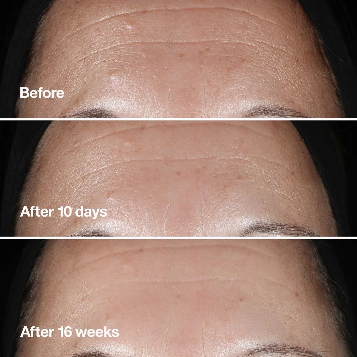 Clinique Smart Clinical rynkekorrigerende serum, 30 ml