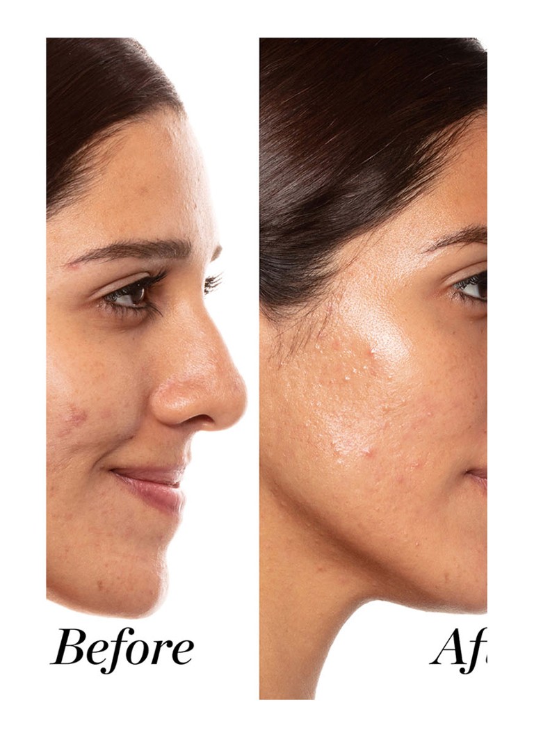 Sunday Riley A+ High-Dose Retinoid Serum
