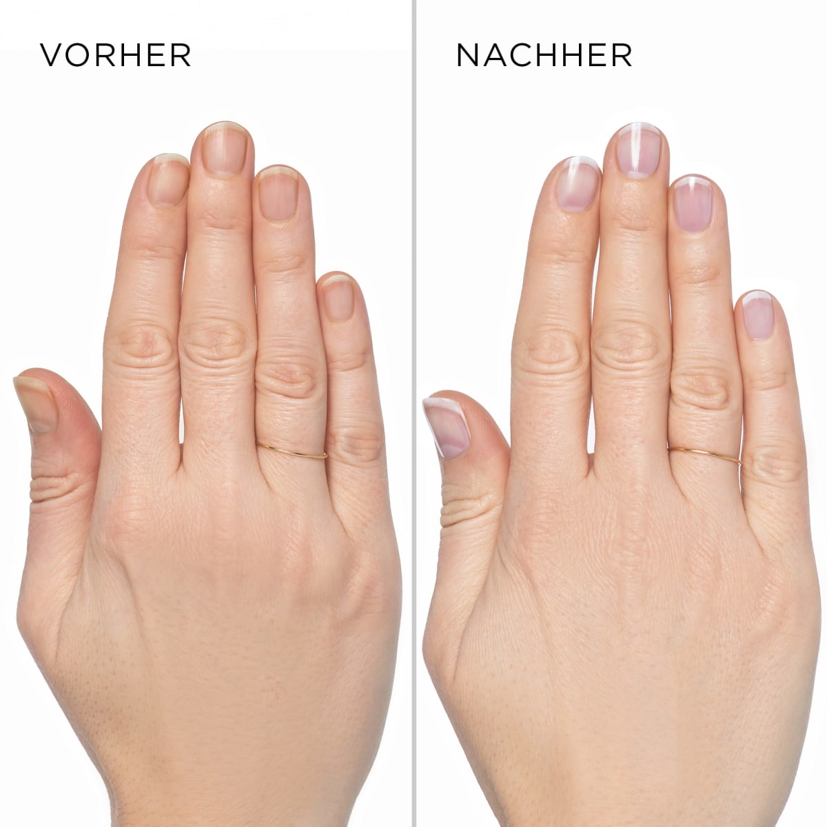 Nagelaufheller Nail Whitener Classic, 10 ml