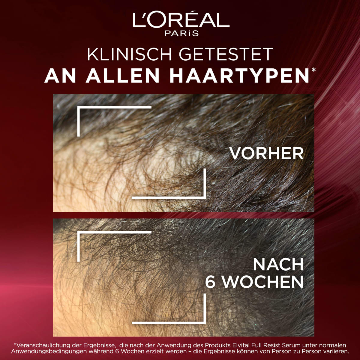 Haarserum Full Resist Anti-Haarverlust, 102 ml
