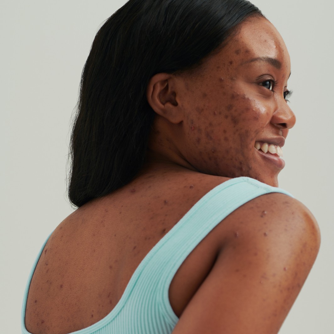 Crema activa dermacosmética DADO SENS