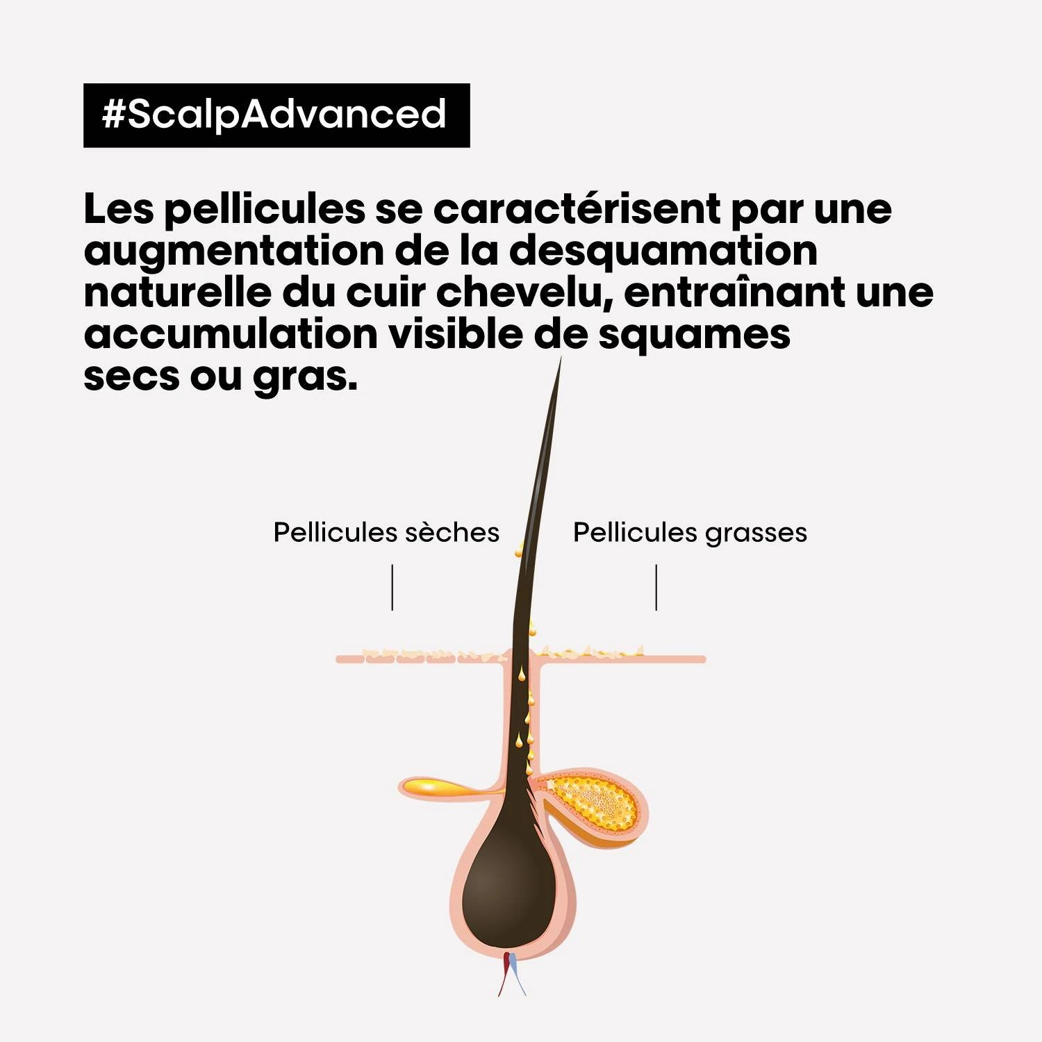 L'Oréal Professionnel Paris Przeciwłupieżowa kuracja oczyszczająca