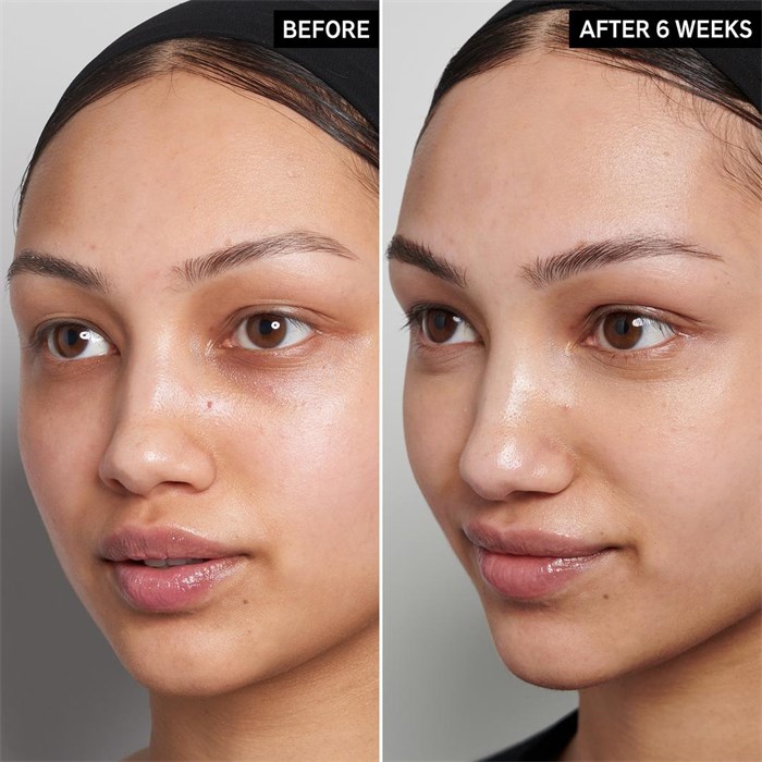 15% Vitamin C And EGF Serum