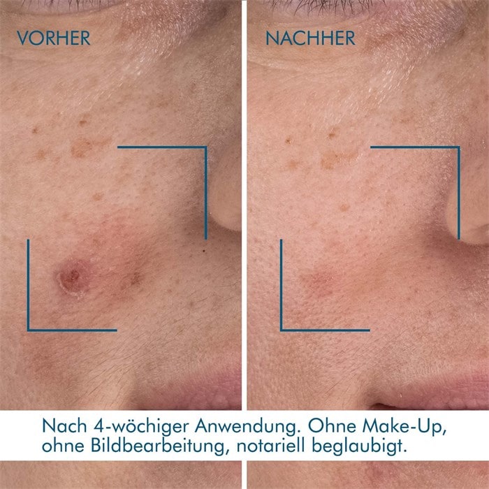 Blue Retinol Resurface + Repair Night Serum
