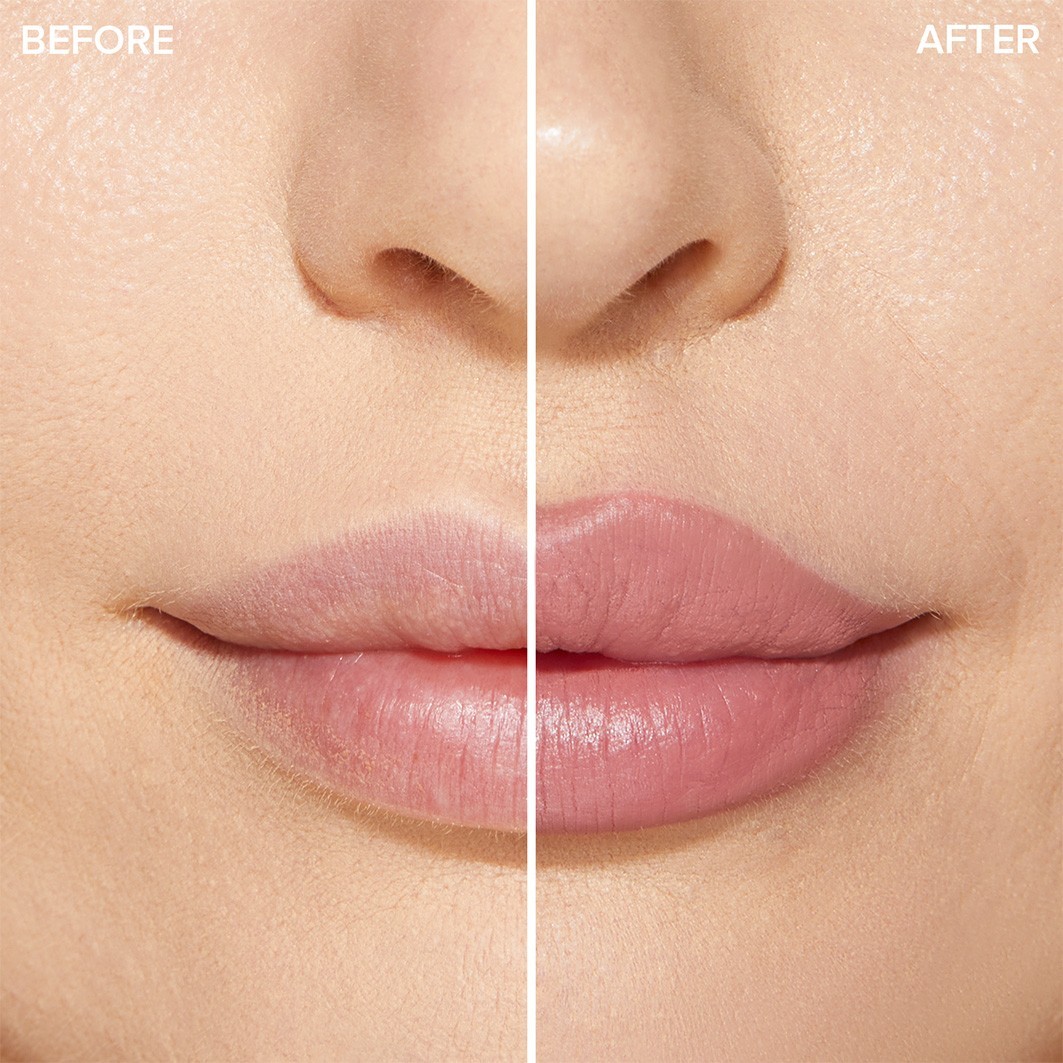 Extreme Lip Shaper