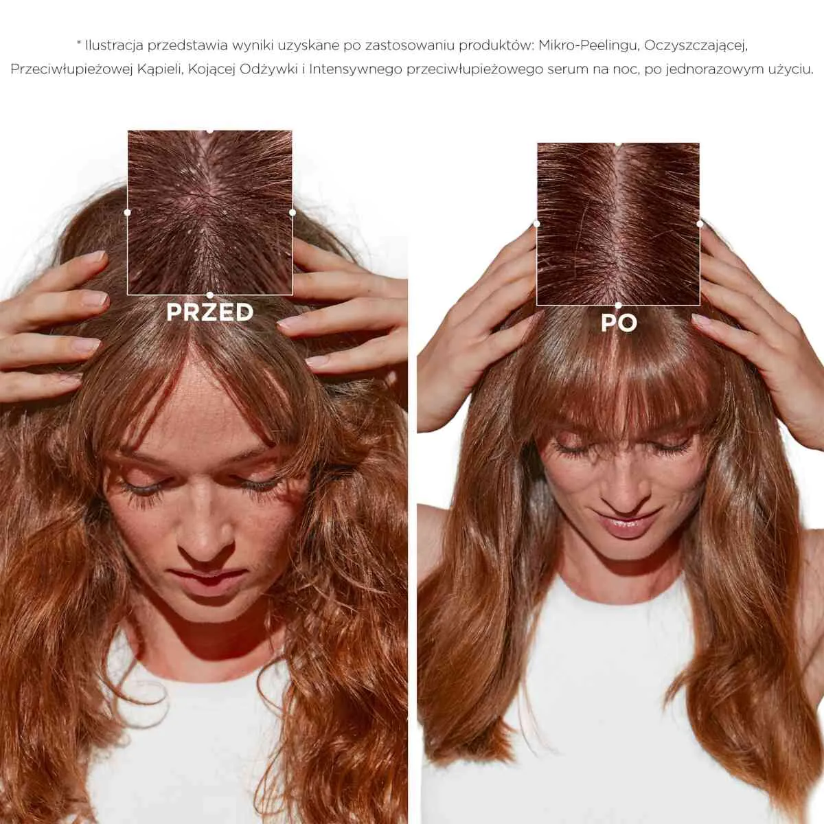 Kérastase Symbiose Soothing Conditioner til sensitiv hovedbund og hår med tendens til skæl