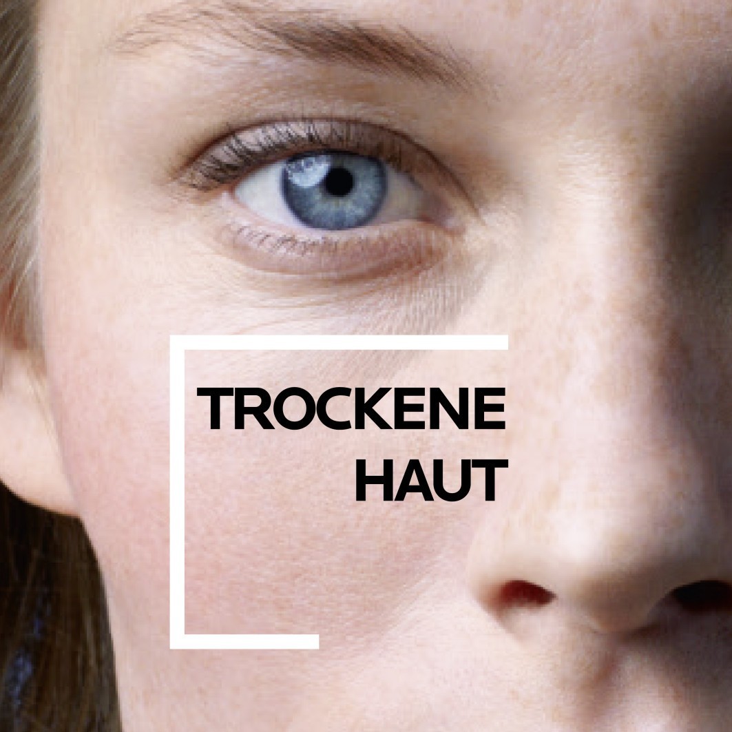 INTENSE AUGEN CREME