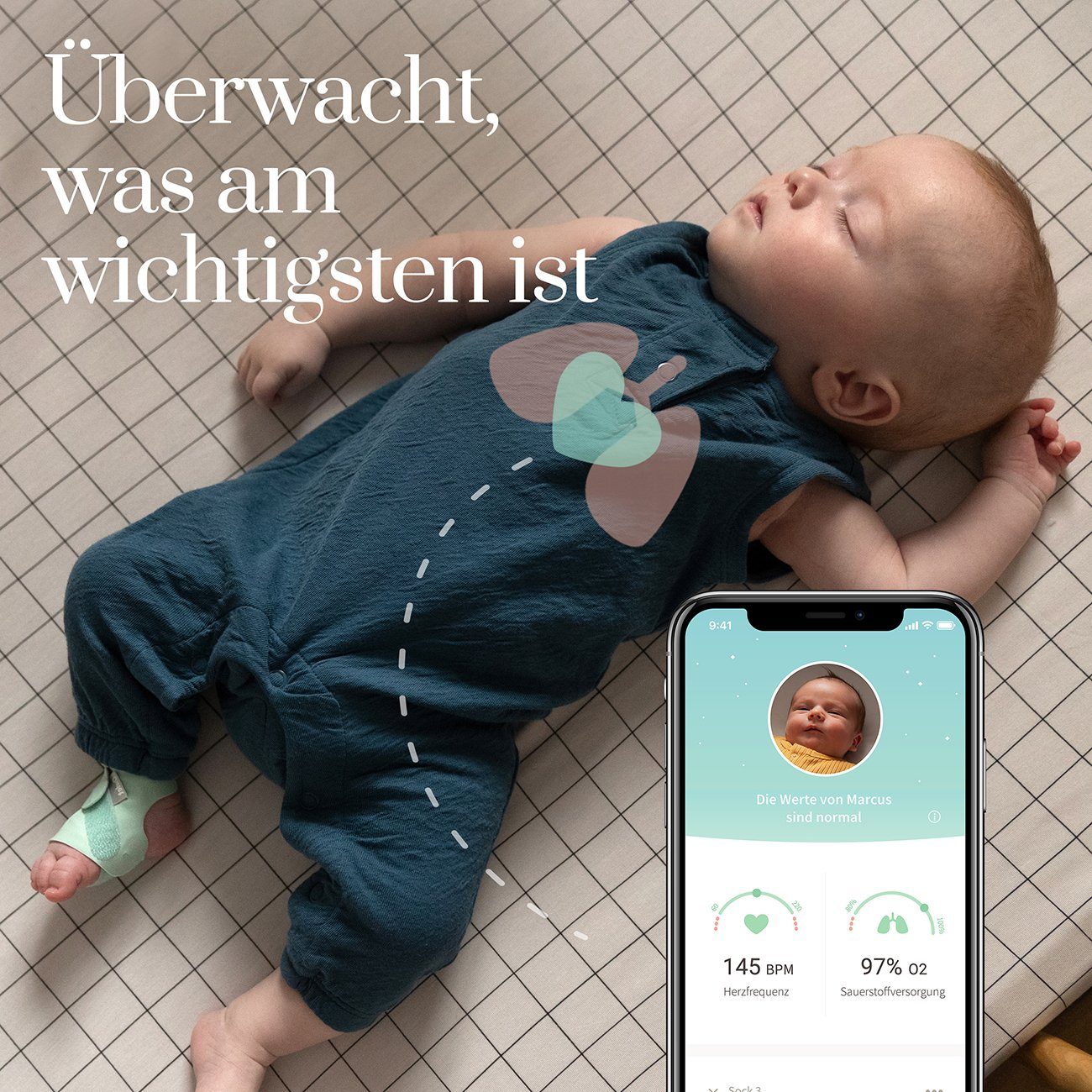 Owlet Baby Care DE Babyphone, Smart Sock, Tracking von Schlaf und Herzfrequenz via App