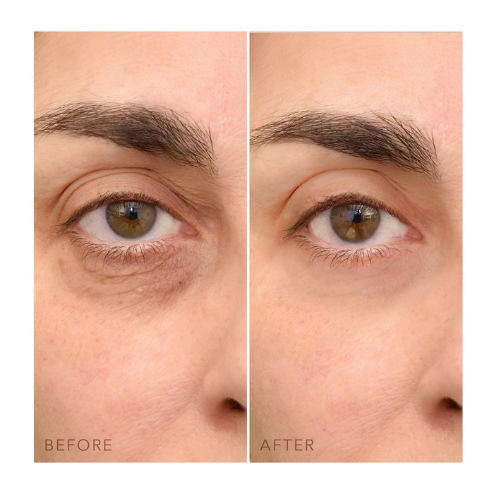 C - Concentrated Eye Cream