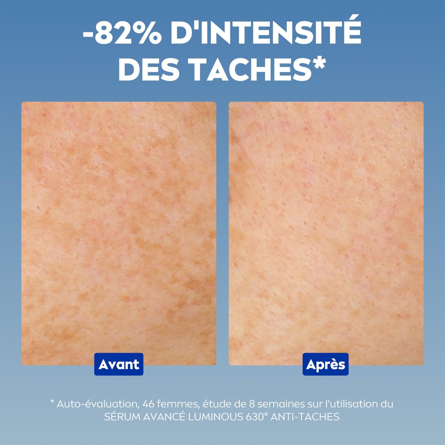 NIVEA sérum na tvár proti tmavým škvrnám a starnutiu pleti