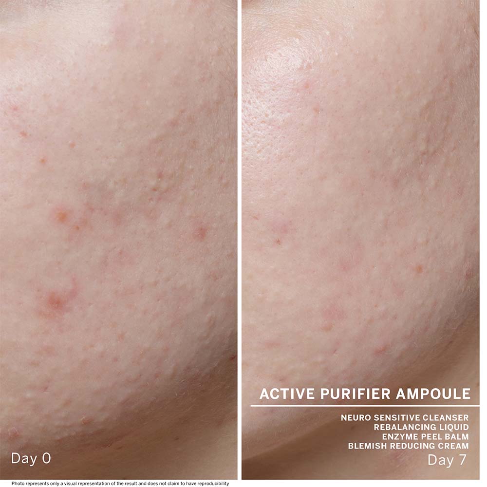 BABOR Ampoule Concentrates Active Purifier 7x2 ml