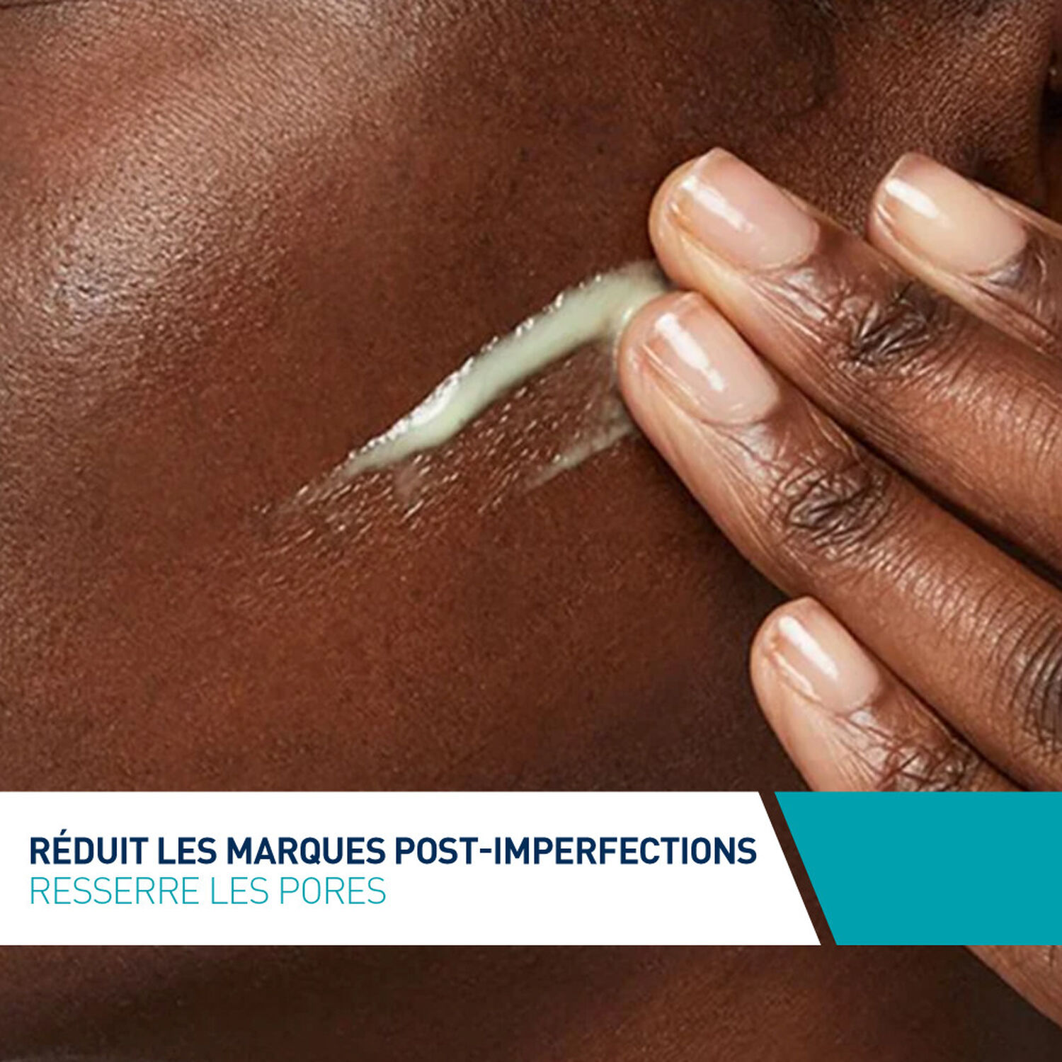 Cerave Rénitol Anti-Marques Sérum Réduisant L'Apparence des Marques 30 ml