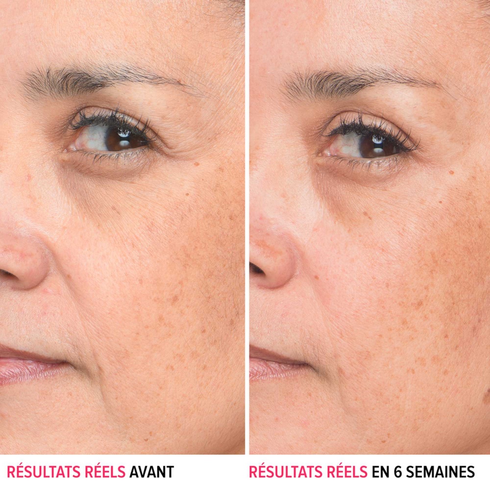It Cosmetics Bye Bye Serum Sérum anti-ride à l'acide hyaluronique