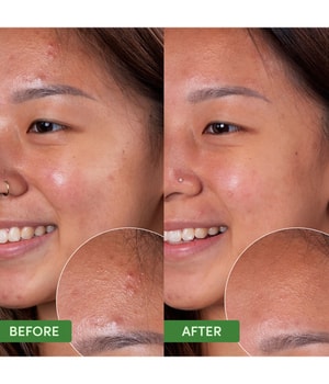 Sand & Sky Oil Control Clearing Face Mask Gesichtsmaske-100 g