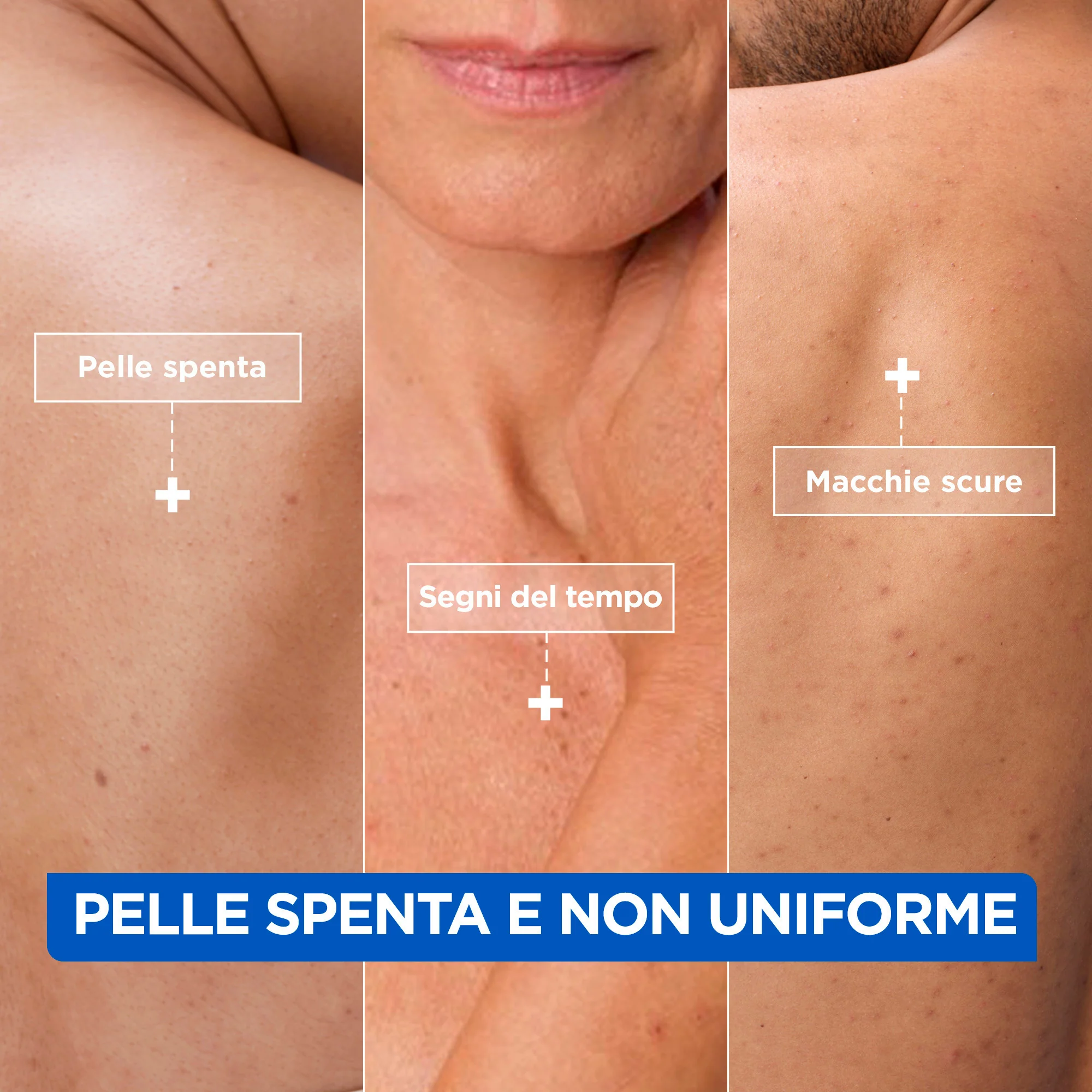 Niacinamid Bright Body - Hidratáló - Testápoló Krém, Világosító Testápoló Krém