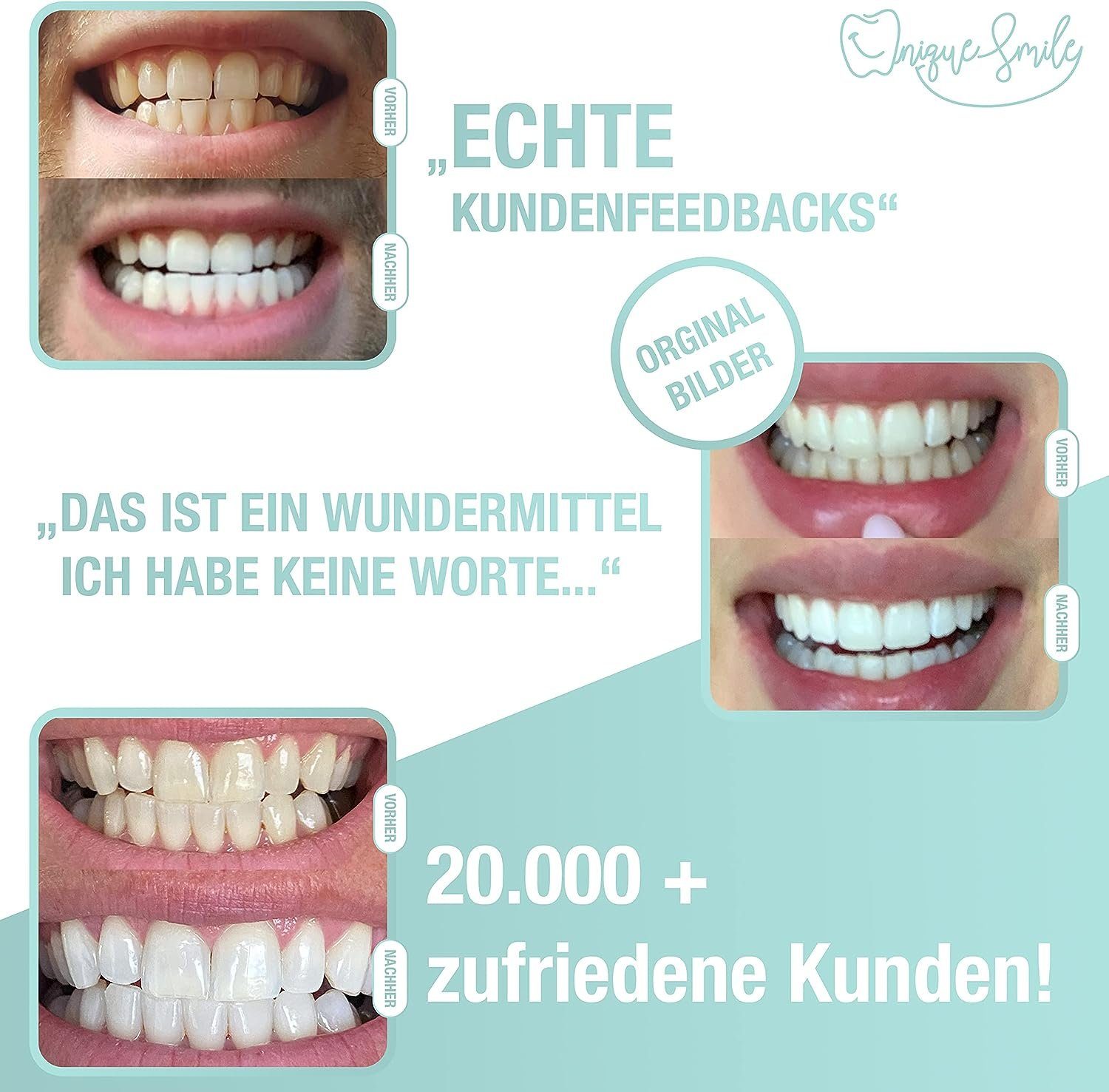 Uniquesmile Zahnbleaching-Gel Nachfüllstifte, PAP Formel, LED Technologie, schmerzfrei, frei von Schadstoffen.