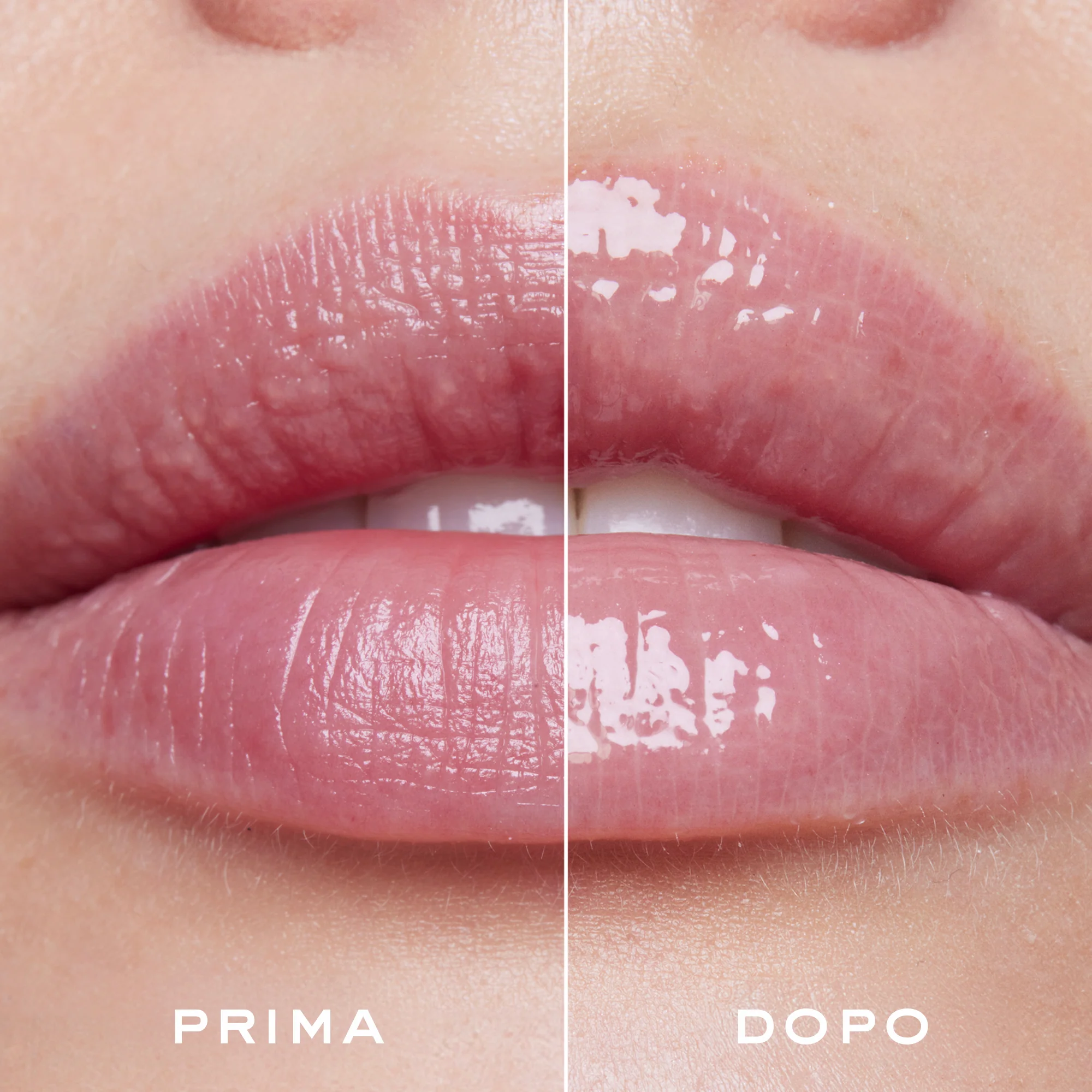Serum za popunjavanje usana Very Rose - Volumizer za usne