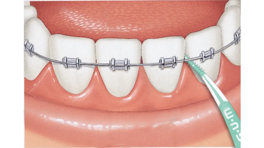 GUM® SOFT-PICKS® ADVANCED Medium