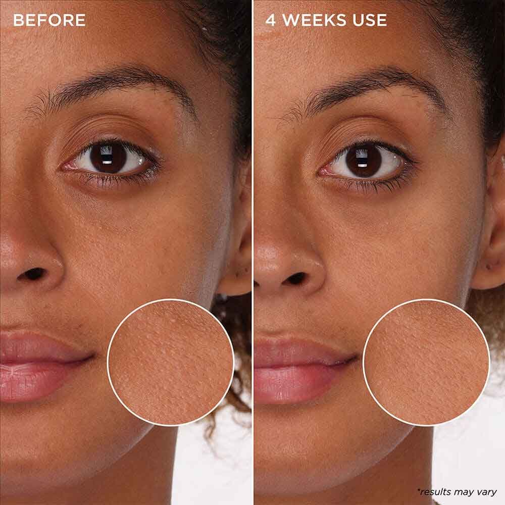Benefit Reinigung The POREfessional Tight &'n Toned - Poren verfeinernder Schaum-Toner mit AHA+PHA