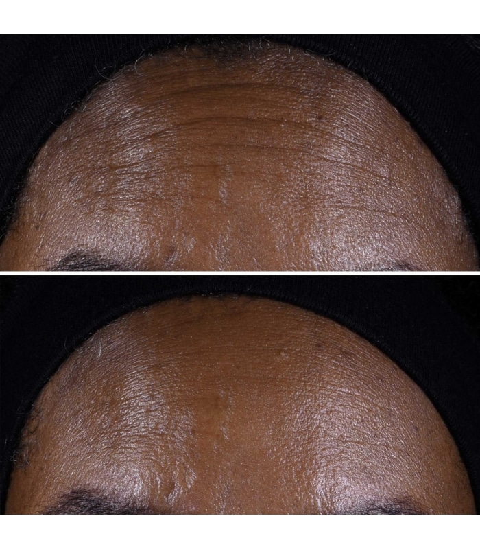 Clinique-SMART CLINICAL-Smart Clinical Repair™ Crème Liftante Visage + Cou