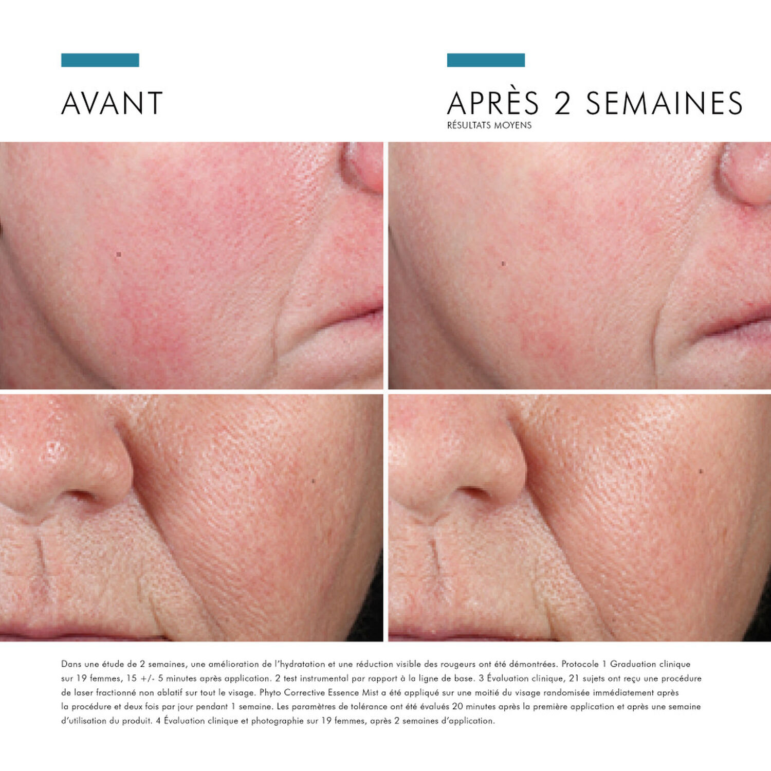 Skinceuticals Phyto Corrective Essence Mist Brume Apaisante et Hydratante 60 ml