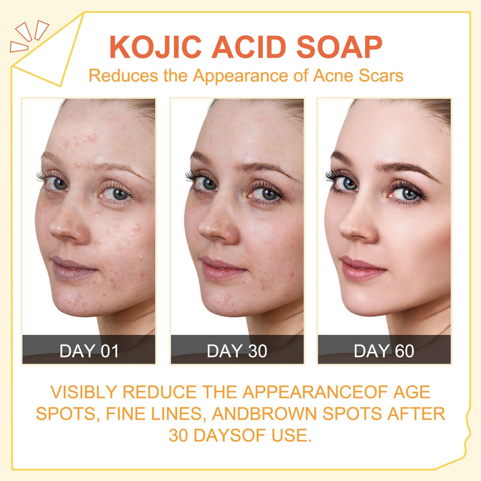 XDeer Seifen-Set Skin Lightening Kojie San Skin Lightening (2 Seifen : 2x65g), Hautaufhellende Seife mit Kojisäure von Kojic Acid Soap