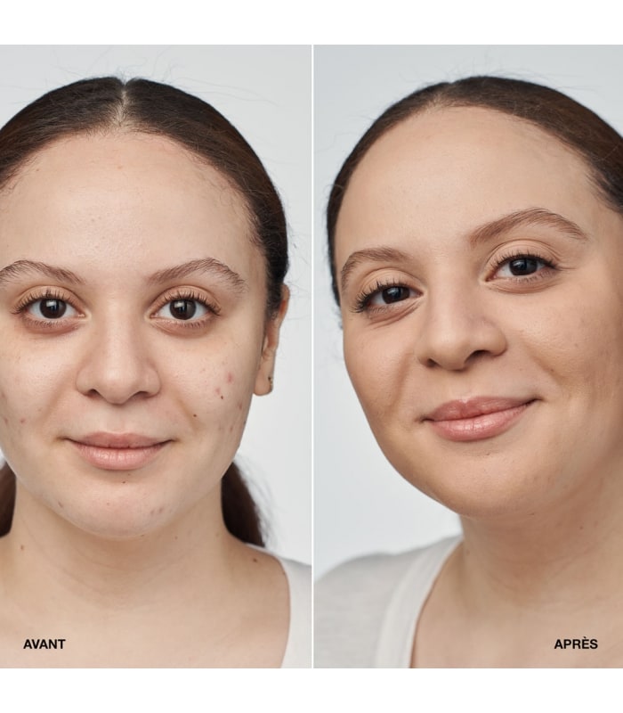 Clinique-EVEN BETTER CLINICAL-Fond de teint sérum SPF 20
