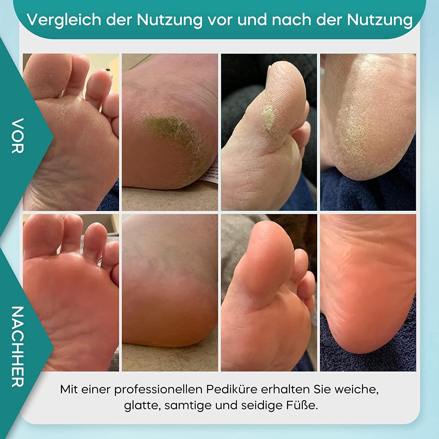 Haiaveng Elektrischer Hornhautentferner Hornhautentferner Elektrisch, Wiederaufladbar Hornhauthobel, für Füsse, Fußpflege Pediküre,Foot File Electric mit 3 Rollen,2 Geschwindigkeiten