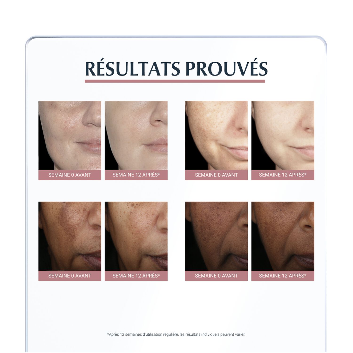 Eucerin Anti-Pigment Crème de Nuit Régénératrice Anti-Tâches - Tous Types de Peaux