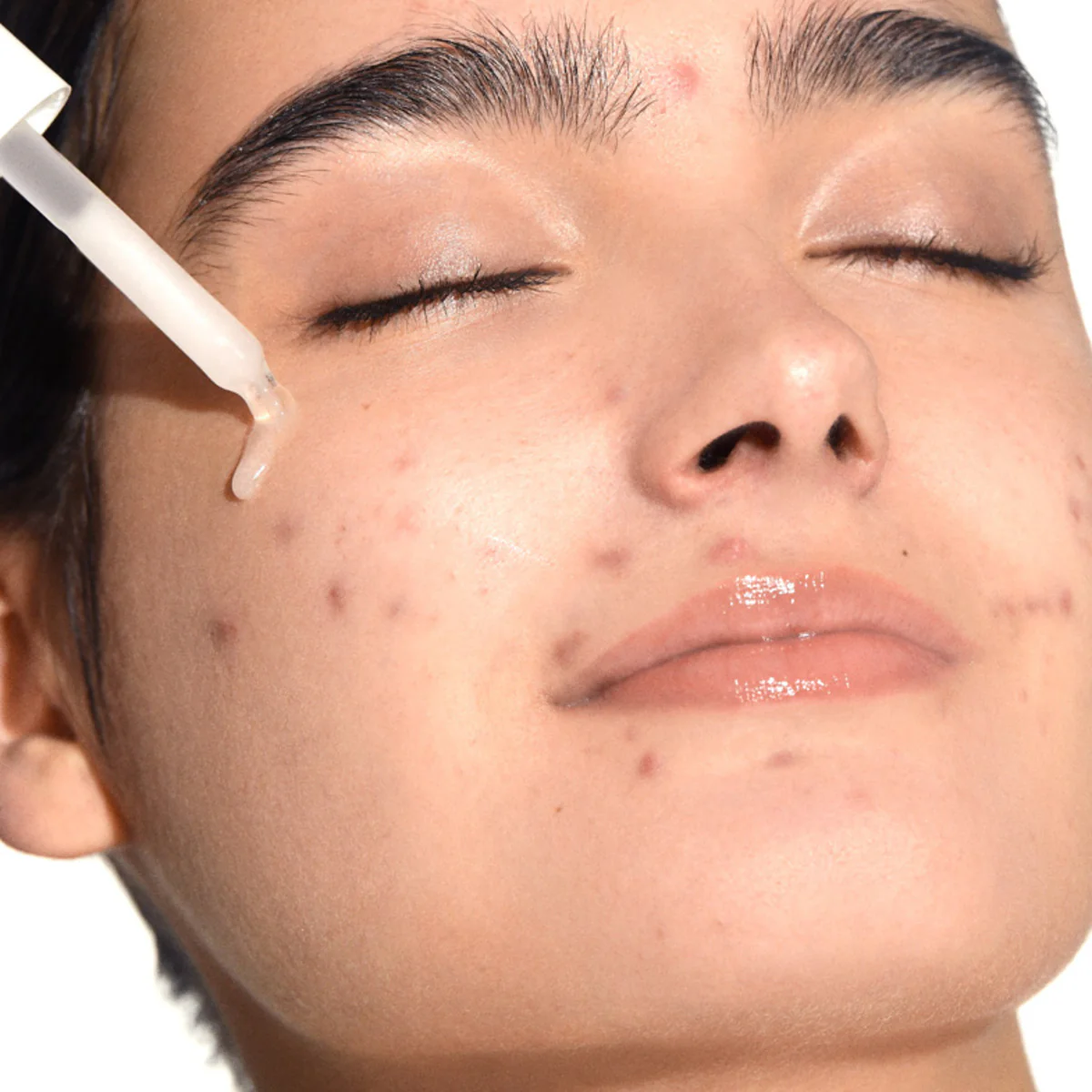 Perfect Serum - Anti-Blemish Face Serum