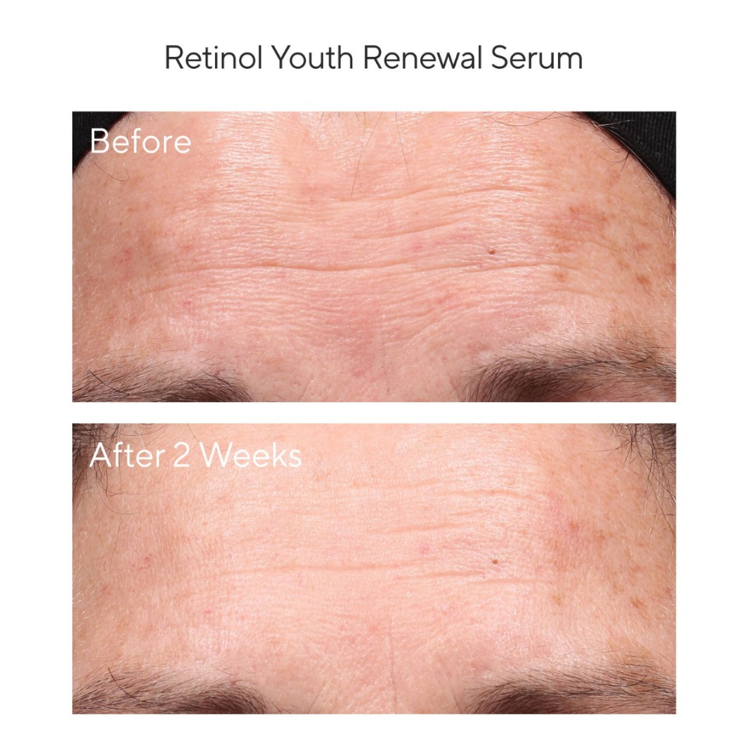 Retinol Youth Renewal Serum