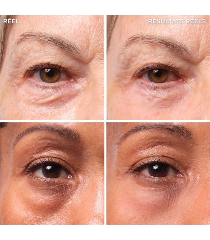 IT COSMETICS-BYE BYE UNDER EYE BAGS-Traitement pour les poches