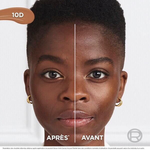 L'Oréal Paris True Match Radiant 10D szérum korrektor 11ml