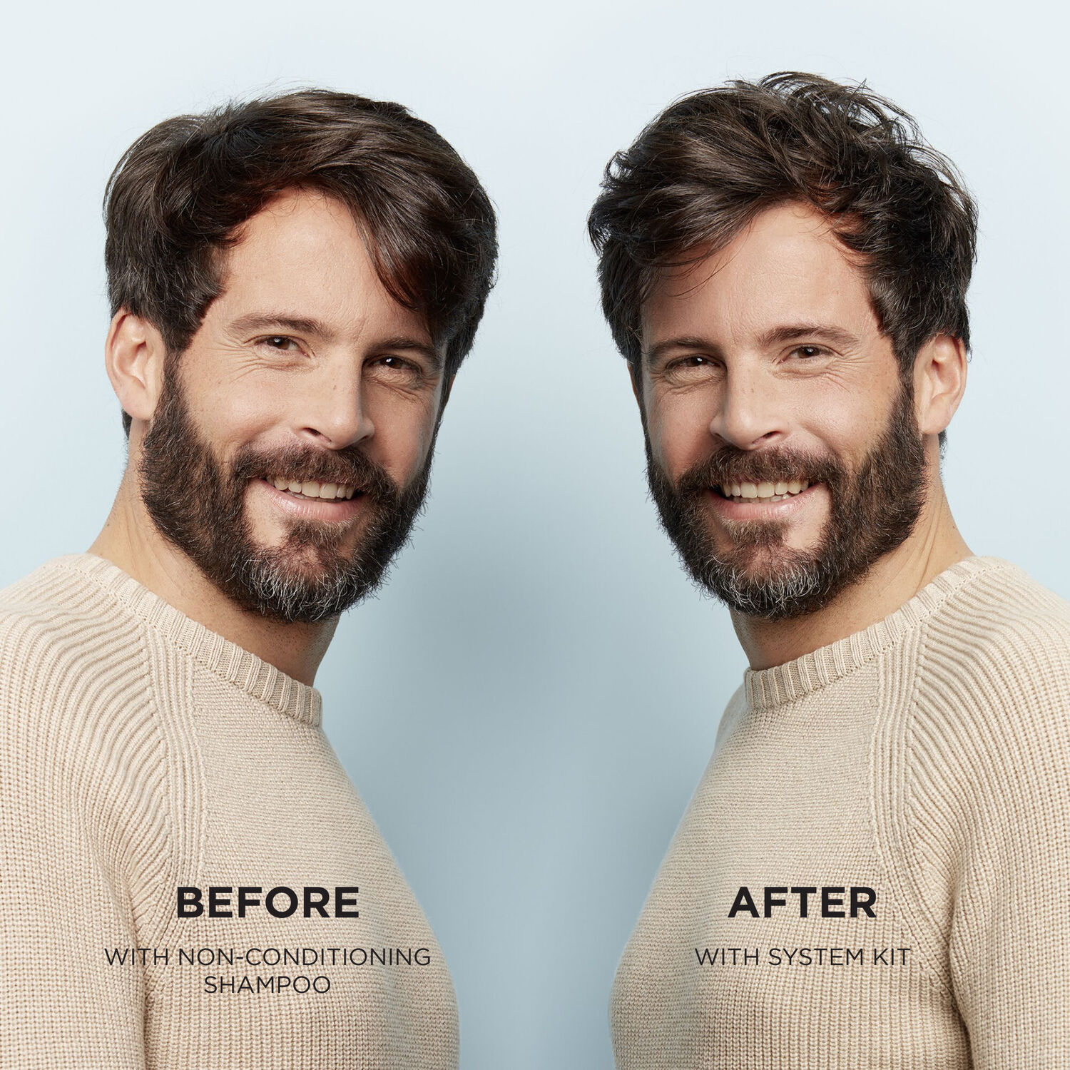 Nioxin System 2 Après-Shampooing Chute Avancée des Cheveux
