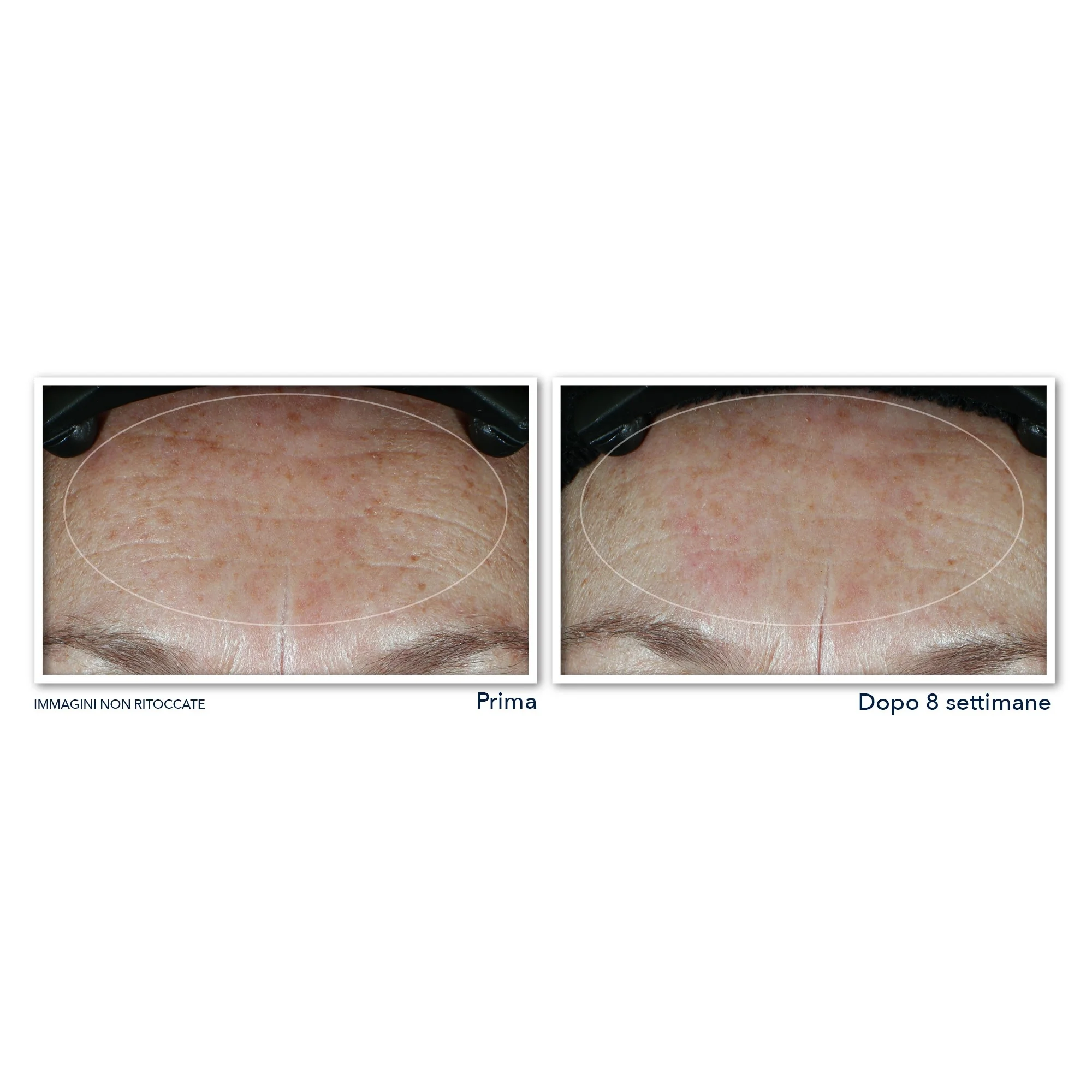 Crema hidratante facial Multi Correxion Hydrate + Plump con SPF30 - Crema hidratante de día, crema de día antiarrugas