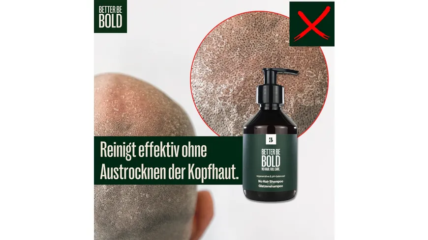 BETTER BE BOLD Pflegendes Glatzenshampoo (0-6mm) 200 ml
