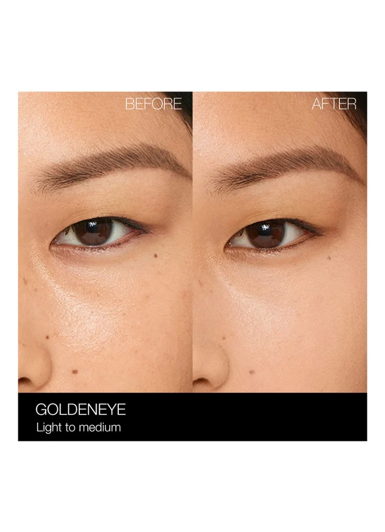 Iluminator ocular cu reflectare a luminii NARS