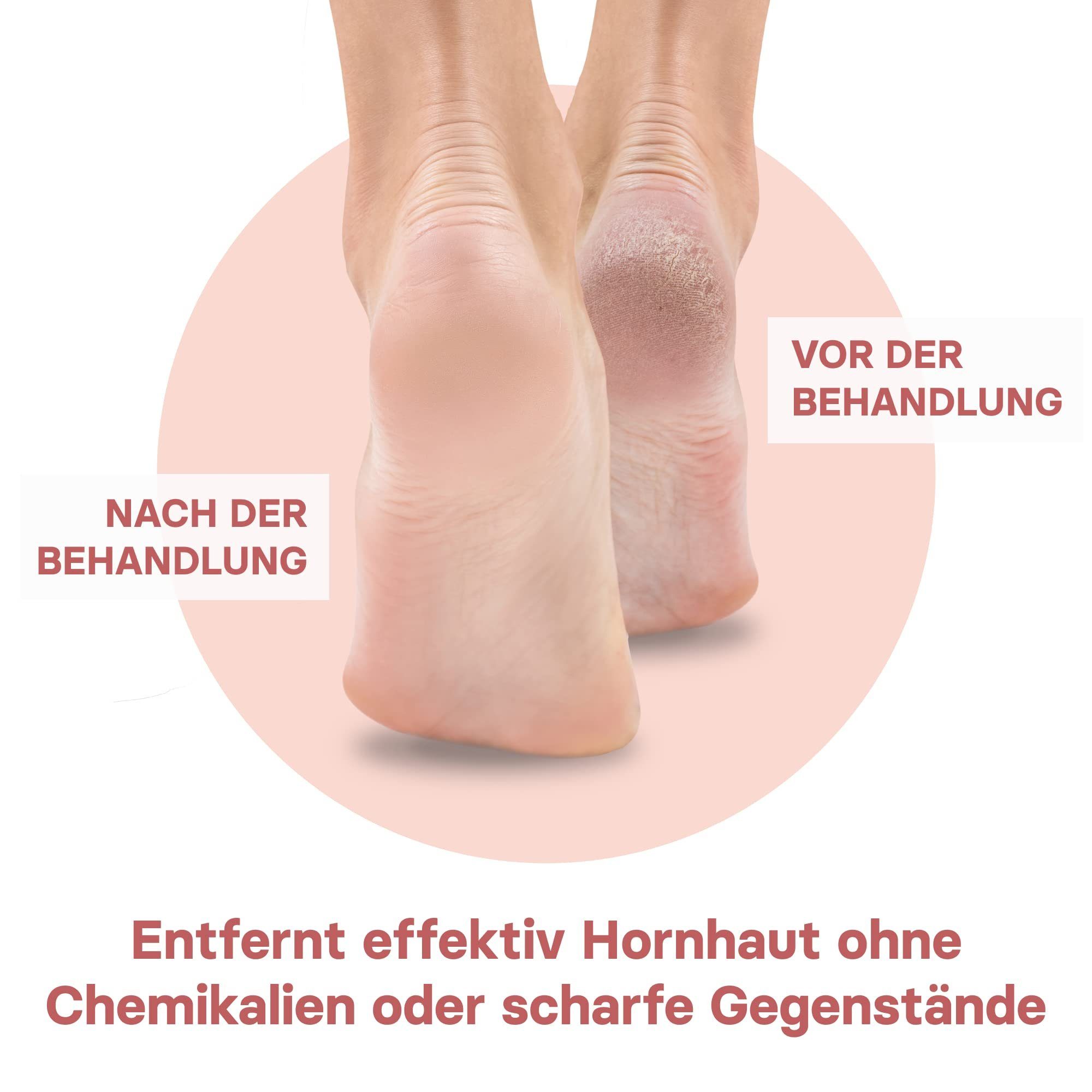VALNEO Bimsstein Bimsstein für Hornhaut - 2er Set, Hornhautentferner - 2er Pack