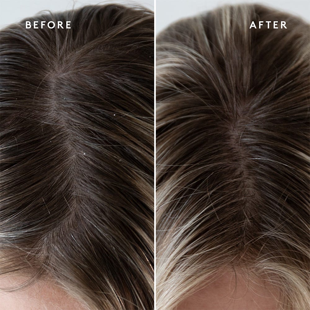 Virtue Refresh Exfoliating Scalp Treatment 150 ml