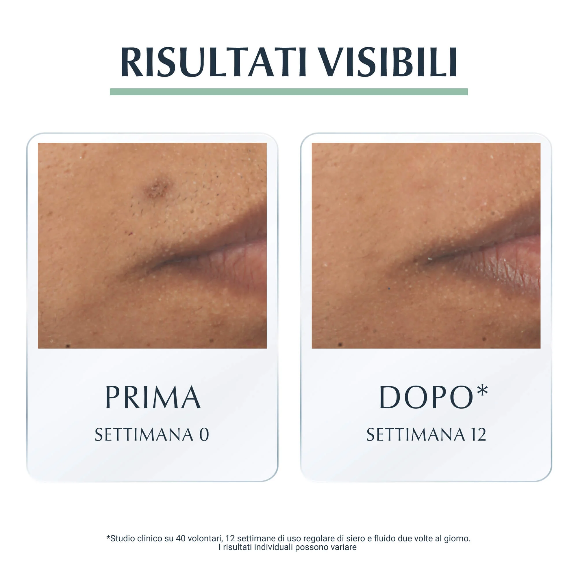 DermoPurifyer serum za kontrolu oil Control Triple Action - Serum za lice s globalnim efektom