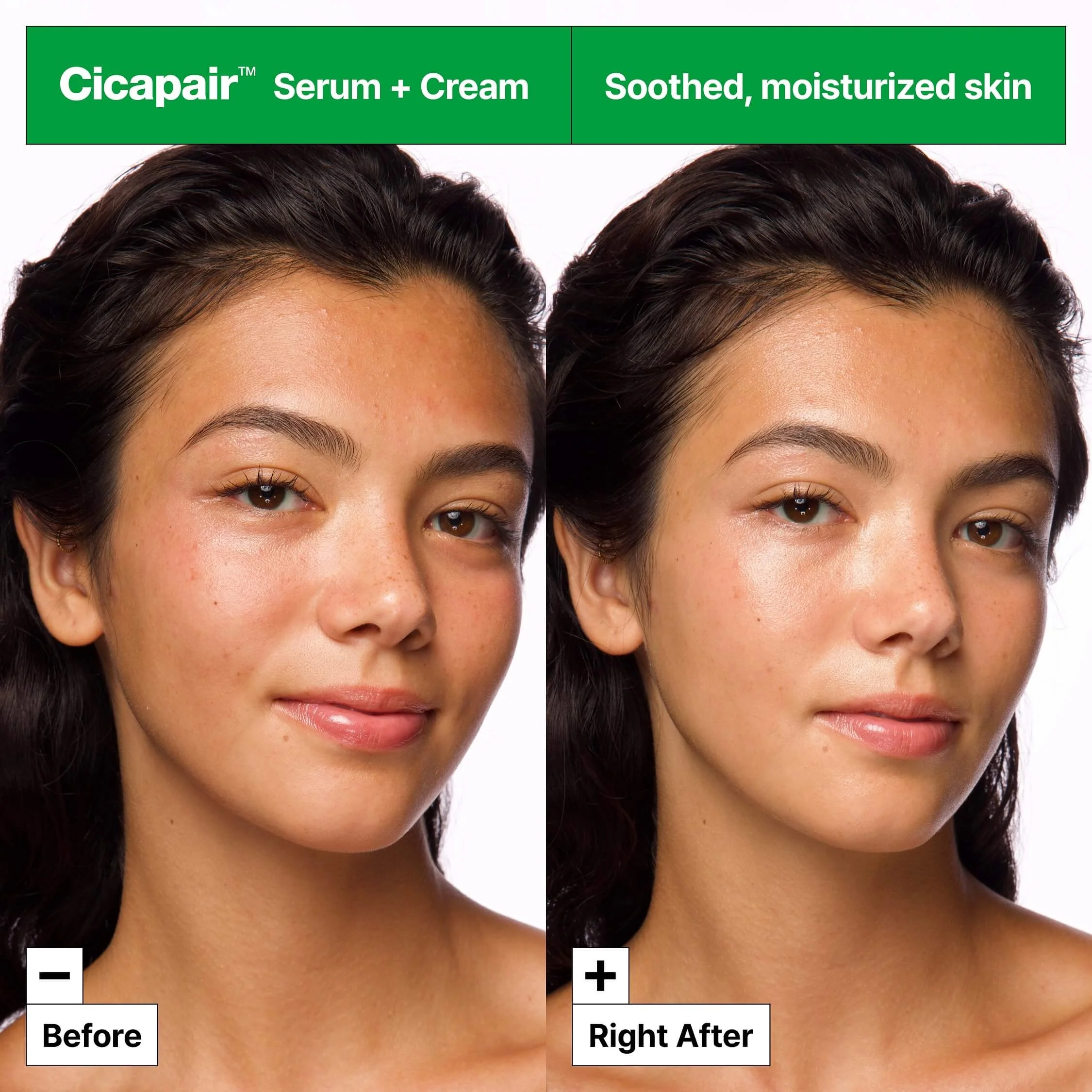Cicapair™ Εντατική Καταπραϋντική Κρέμα Επανόρθωσης - 24ωρη καταπραϋντική θεραπεία προσώπου