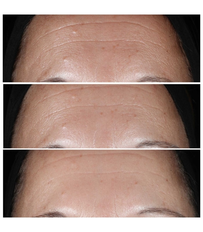 CLINIQUE SMART-Clinique Smart Clinical Repair - Sérum Correcteur Anti-rides