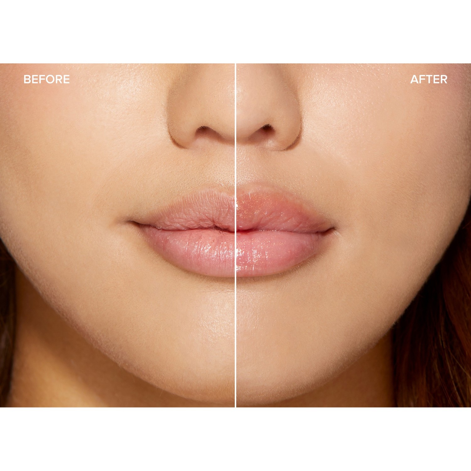 Lip Injection Maximum Plump