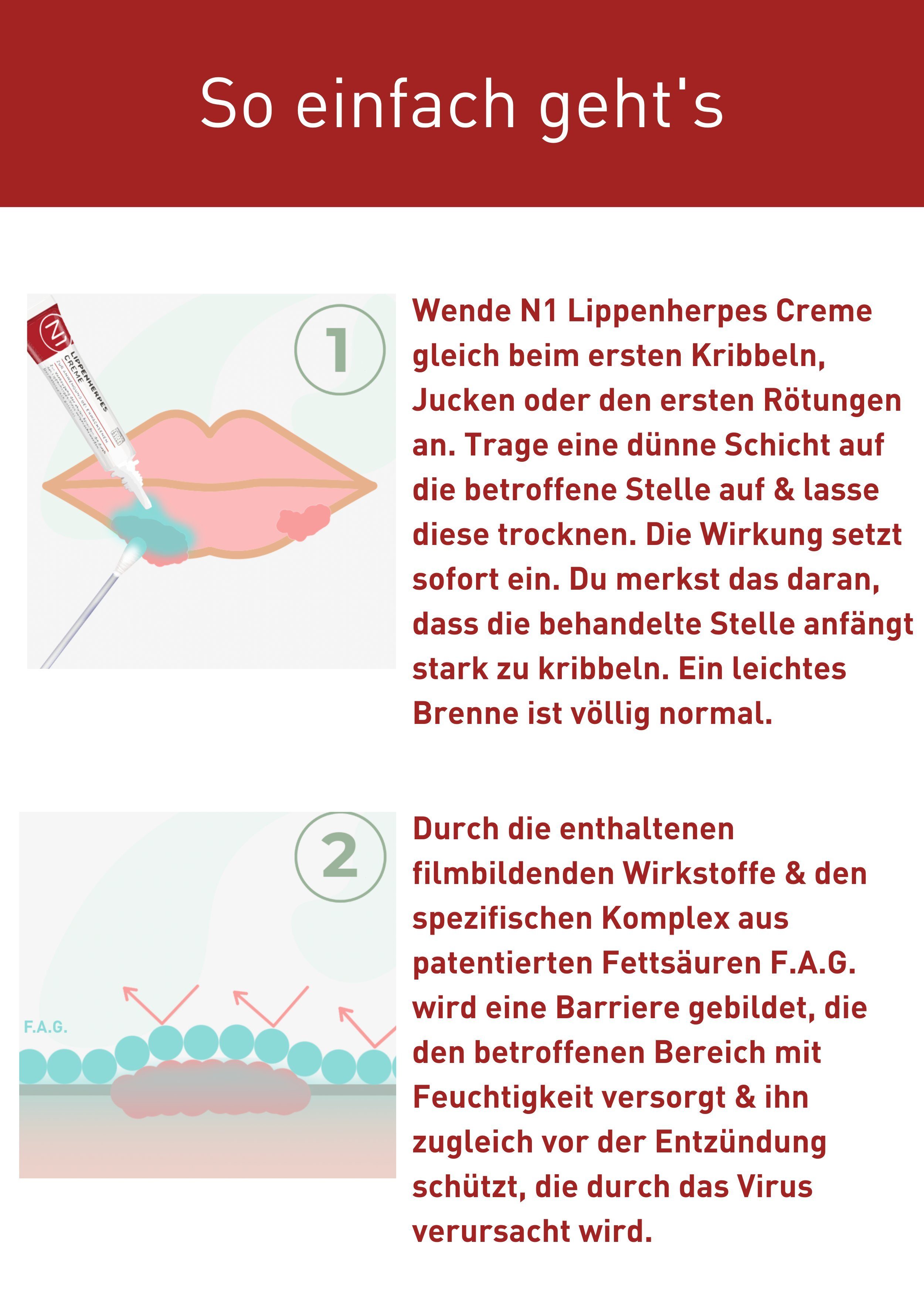 N1 Healthcare Lippencreme Herpes Creme bei Lippenherpes, wirkt sofort, patentiert, geöffnet 6 Monate haltbar