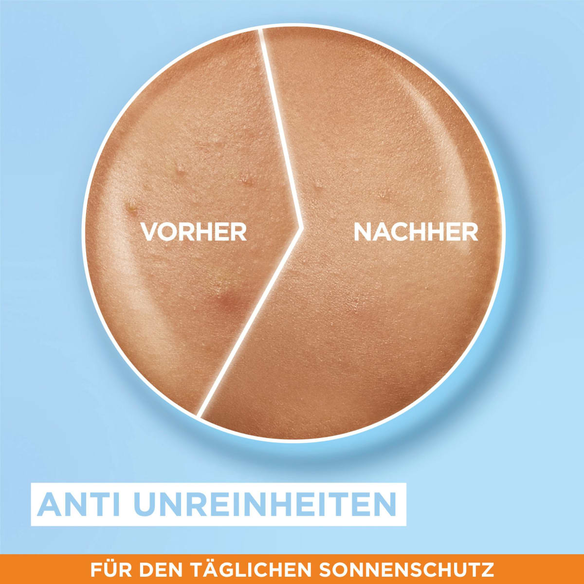 Sonnenfluid Gesicht super UV mit Hyaluronsäure, LSF 50+, 40 ml