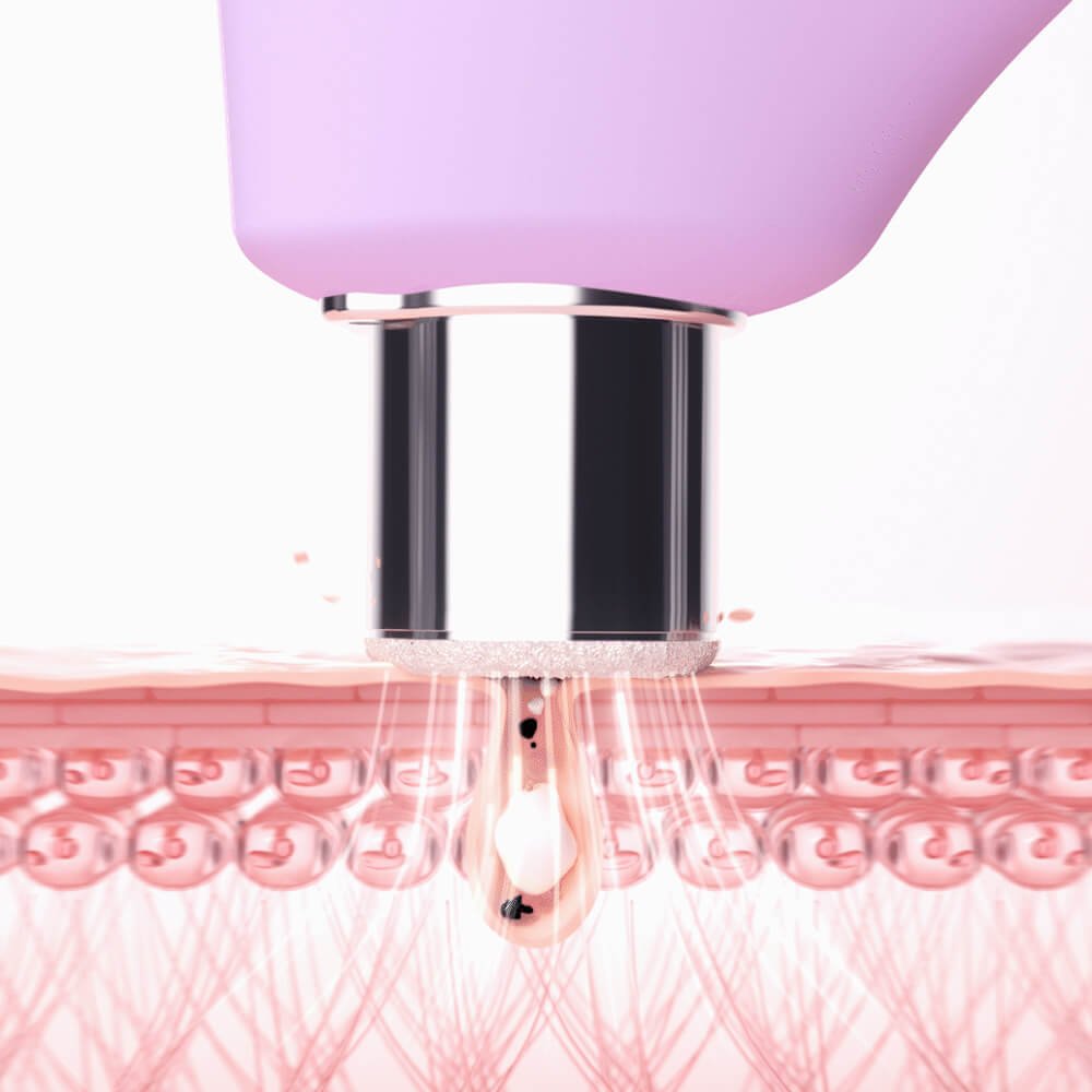 Foreo KIWI™ derma Lavender