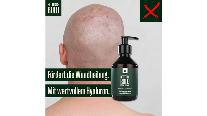 BETTER BE BOLD Pflegendes Glatzenshampoo (0-6mm) 200 ml